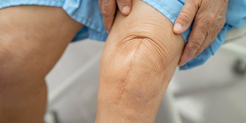 Making the Right Choice: Total Knee Replacement Decision