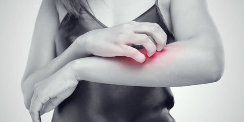 3 Ways to Help Your Child When Their Eczema Gets Worse